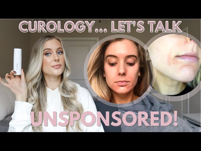 how much is curology
