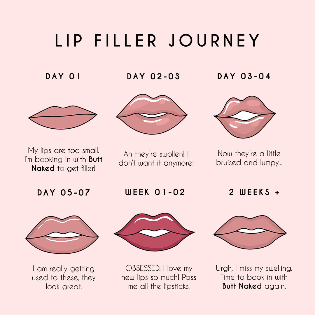 The Lip Filler Before And After Journey